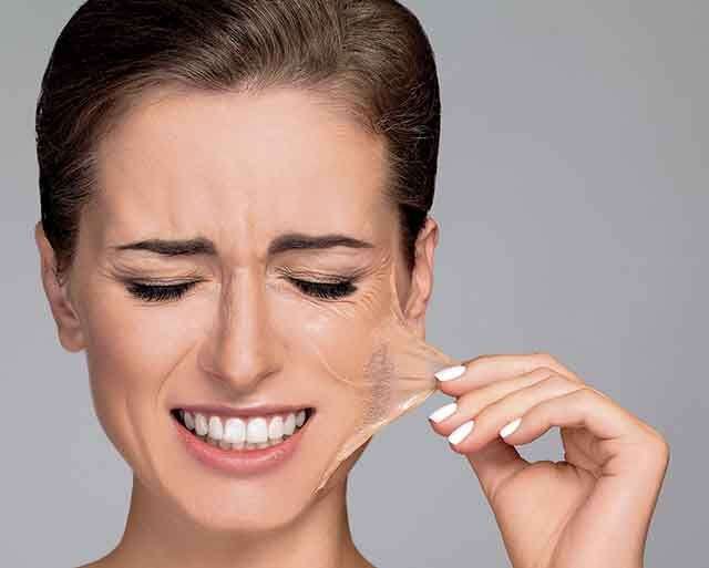 the-benefits-and-side-effects-of-salicylic-acid-peels