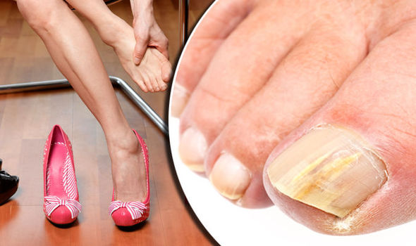 dangers-of-ignoring-toe-nail-fungus-infection