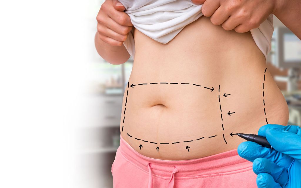 understanding-different-types-of-liposuction-by-staff