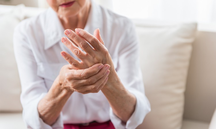 rheumatoid arthritis