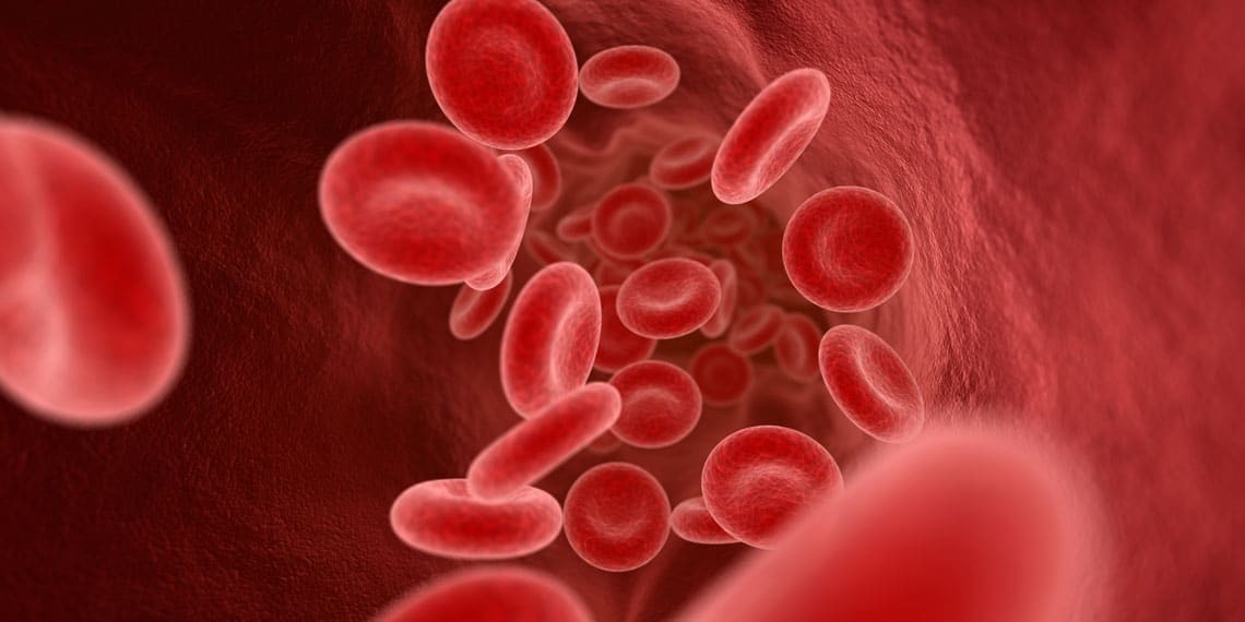 sickle cell anemia