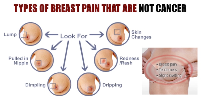 Breast pain