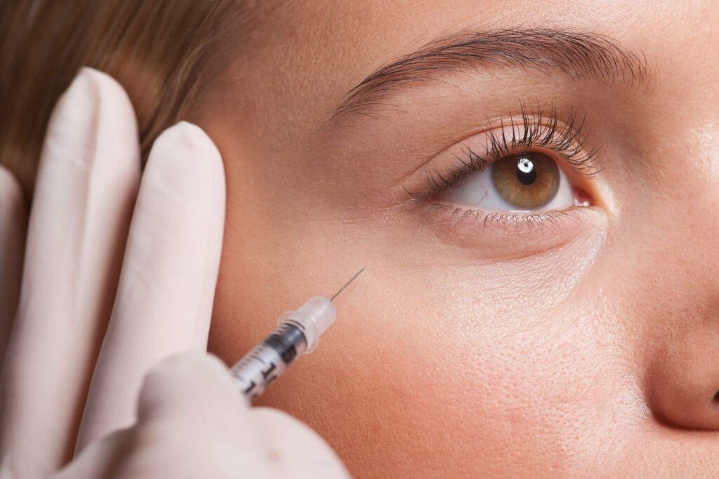 undereye filler