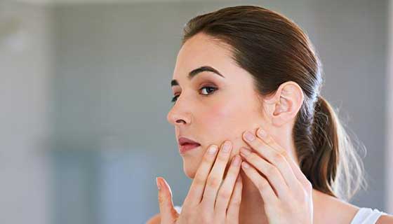 Your Acne May Be Flaring Up